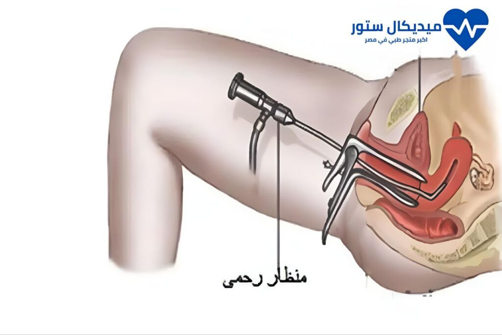 أسباب إجراء منظار الرحم - واهميته ومضاعفاته