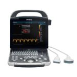 Mindray DP-30 Power Edition Ultrasound Imaging System 1 Mindray DP-30 Power Edition Ultrasound Imaging System Mindray DP-30 Power Edition Ultrasound Imaging System