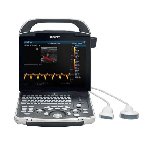 Mindray DP-30 Power Edition Ultrasound Imaging System Mindray DP-30 Power Edition Ultrasound Imaging System