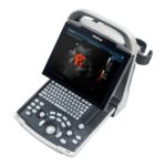 Mindray DP-30 Power Edition Ultrasound Imaging System