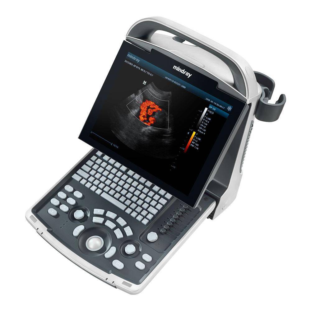 جهاز سونار ديجيتال DP-30 جهاز سونار ديجيتال DP-30